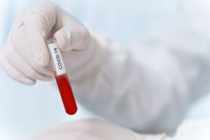 Mão com luva cirúrgica segurando tubo de ensaio contendo um líquido vermelho. O tubo de ensaio contém a inscrição COVID-19.